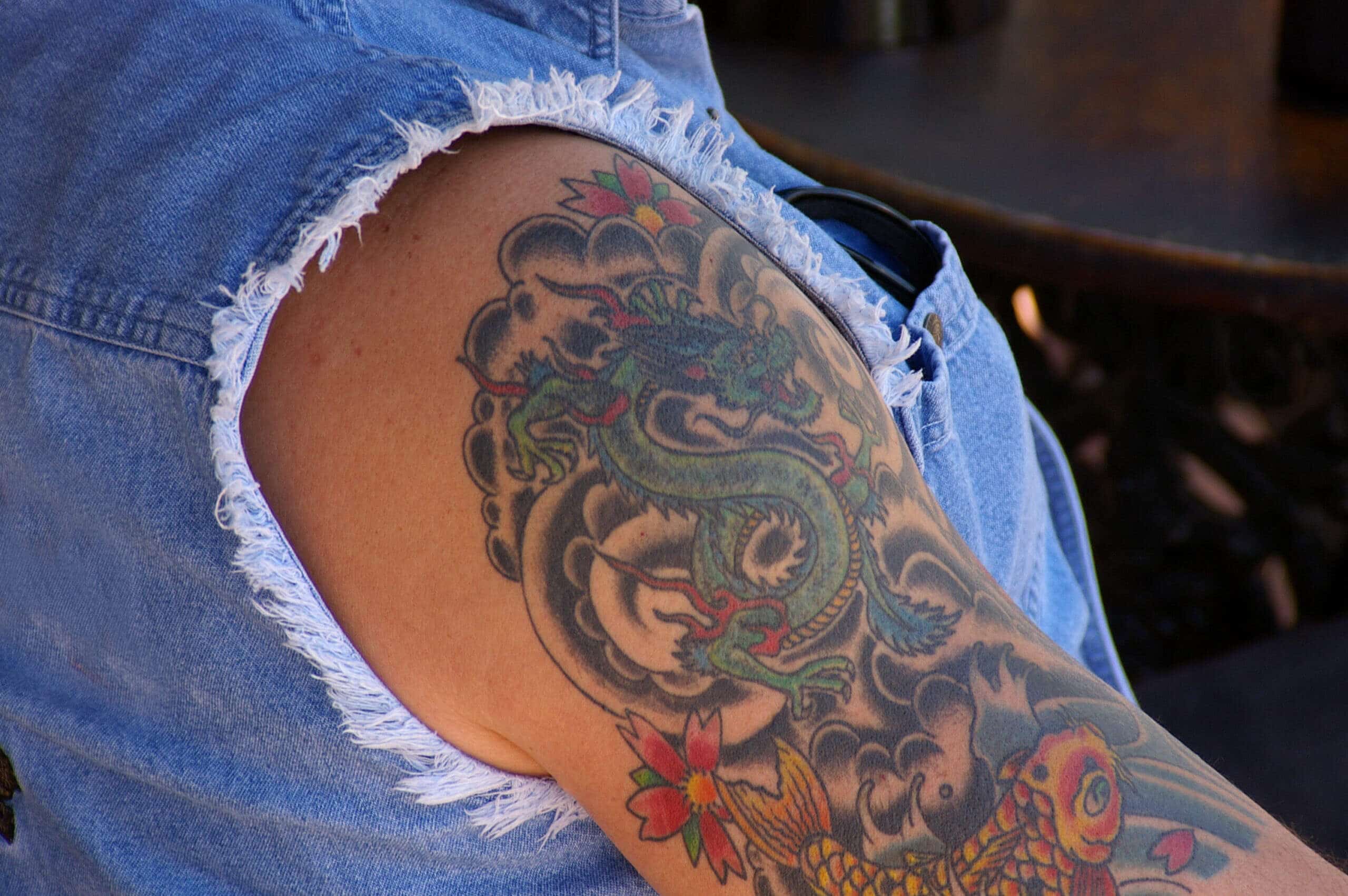 Potential Risks of Laser Tattoo Removal - Orange Coast Aesthetics