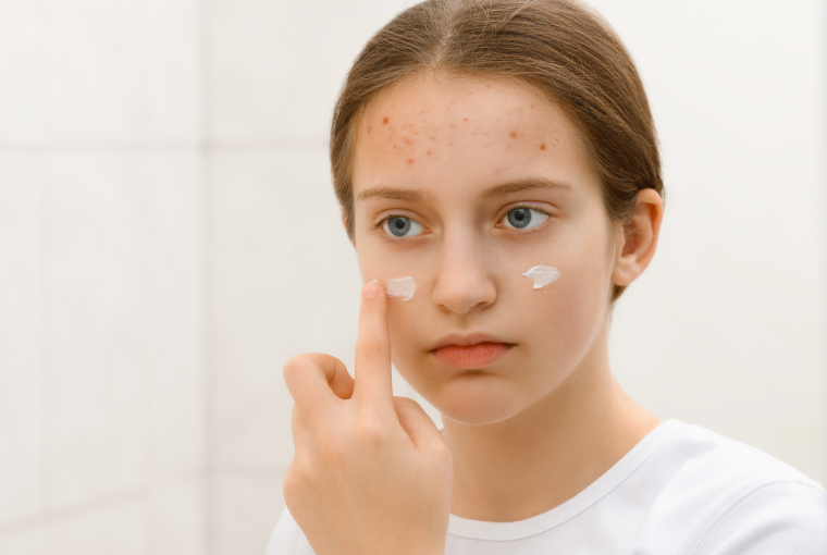 attract student clients to your spa with posts that resonate and tackle skincare issues they are facing